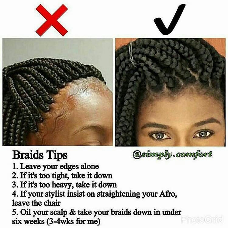 It’s protective style season and your edges are at their weakest. Please do not …