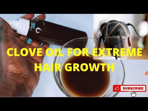 NO JOKES! DIY CLOVE OIL FOR NATURAL HAIR GROWTH!! HOW TO MAKE DIY CLOVE OIL FOR HAIR GROWTH