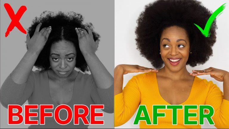 DRY, ITCHY SCALP? Cure it FAST | 4C Natural Hair